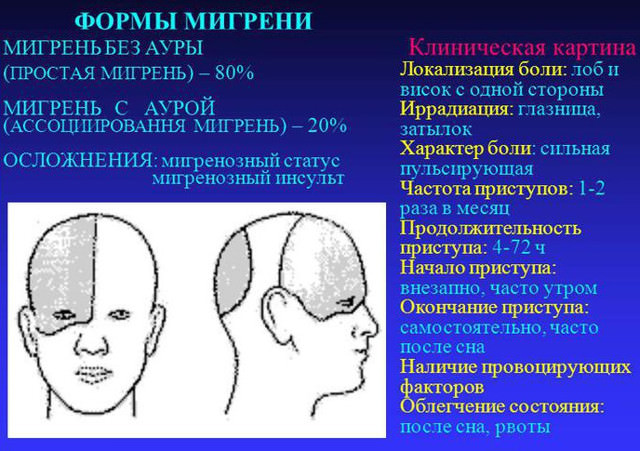 Как лечить мигрень у мужчин: причины, симптомы и лечение