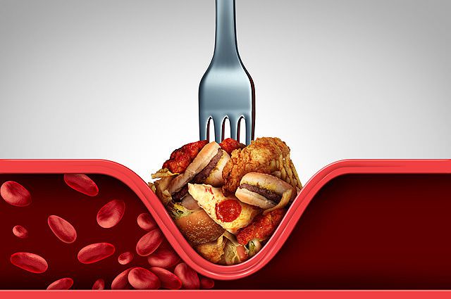 Как очистить сосуды от холестерина