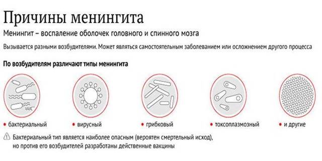 Как определить менингит у ребенка, диагностирование в домашних условиях