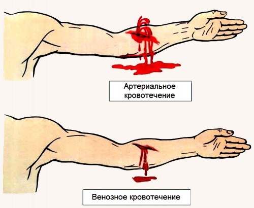 Как остановить кровь из ранки