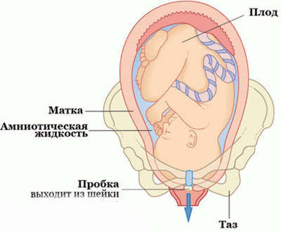 Как отходят воды перед родами, что означают зеленые воды при родах