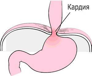 Как отличить невроз от других заболеваний: правила дифференцирования невроза от грыжи пищеводного отверстия диафрагмы