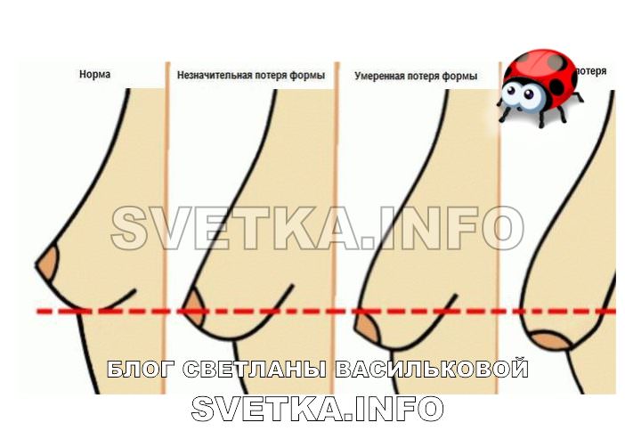 Как подтянуть грудь в домашних условиях &mdash; упражнения, массаж, увлажнение