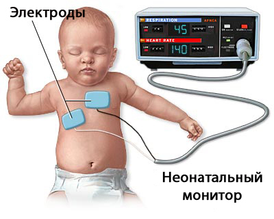 Как предотвратить синдром внезапной детской смерти: риски, симптомы, профилактика