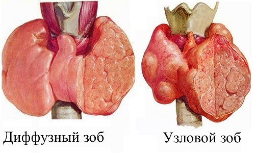 Как расшифровать анализ крови на гормоны щитовидной железы: о чем говорит понижение т4 при повышенном ттг