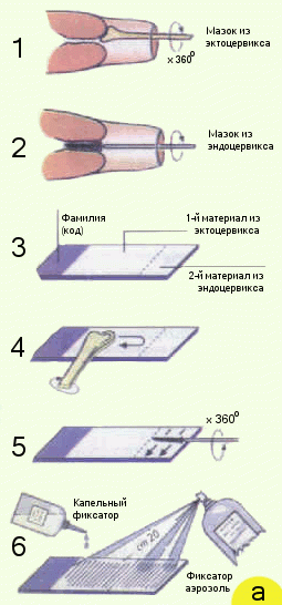 Как расшифровать цитологический анализ