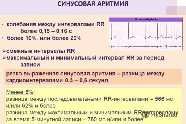 Как расшифровать экг сердца и диагностировать патологии сердца по экг