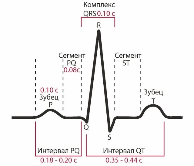 Как расшифровать экг сердца и диагностировать патологии сердца по экг