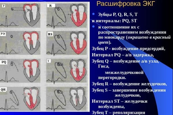 Как расшифровать экг сердца и диагностировать патологии сердца по экг