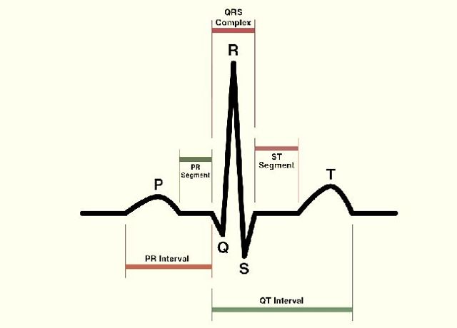 Как расшифровать экг сердца и диагностировать патологии сердца по экг