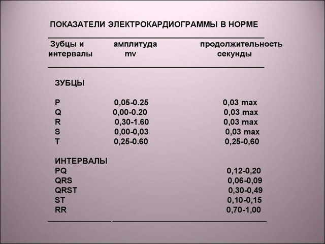 Как расшифровать экг сердца и диагностировать патологии сердца по экг