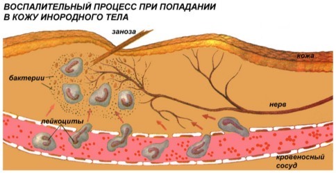 Как расшифровать оак и о чем говорит повышенный уровень базофилов