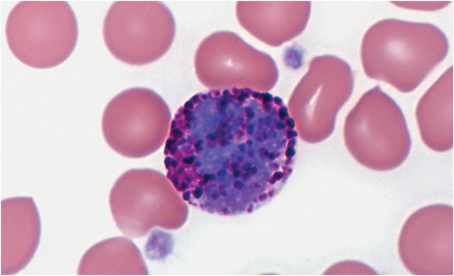 Как расшифровать оак и о чем говорит повышенный уровень базофилов