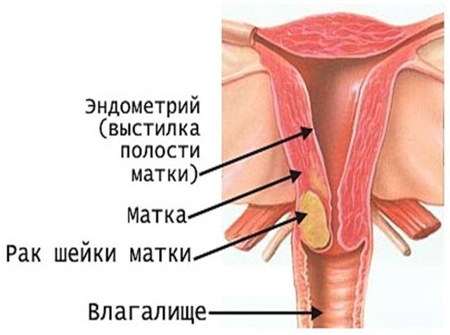 Как расшифровать результат анализа на scc?