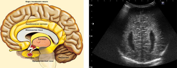 Как расшифровать результаты нейросонографии ребенка?
