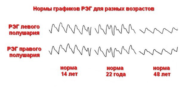 Как расшифровать заключение рэг?