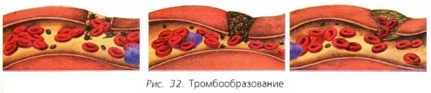 Как разжижать кровь при высоком гемоглобине?