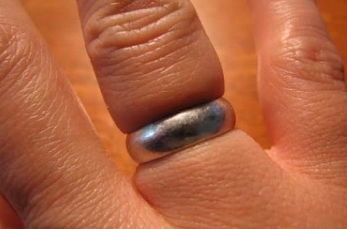 Как снять кольцо с опухшего пальца самостоятельно дома, причины отека