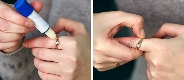 Как снять кольцо с опухшего пальца самостоятельно дома, причины отека