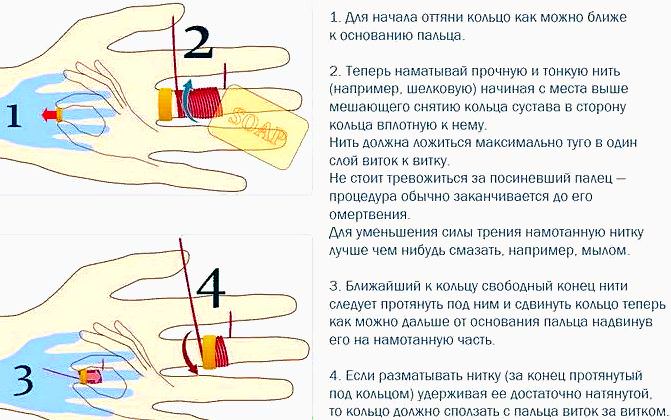 Как снять кольцо с опухшего пальца самостоятельно дома, причины отека