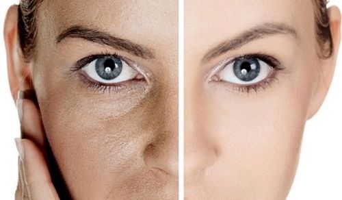 Как сузить расширенные поры на лице