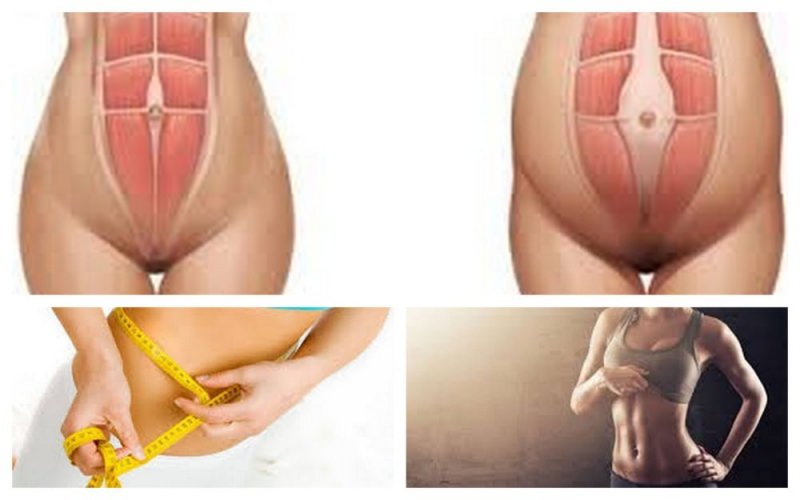 Как убрать лишний жир с живота