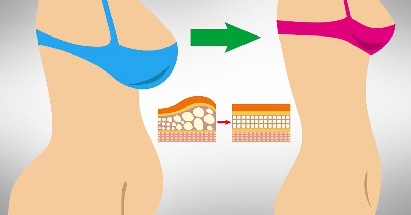 Как убрать лишний жир с живота