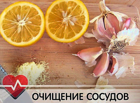 Как укрепить сосуды &mdash; причины и симптомы слабых сосудов, диета, народные способы