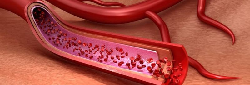 Как укрепить сосуды &mdash; причины и симптомы слабых сосудов, диета, народные способы
