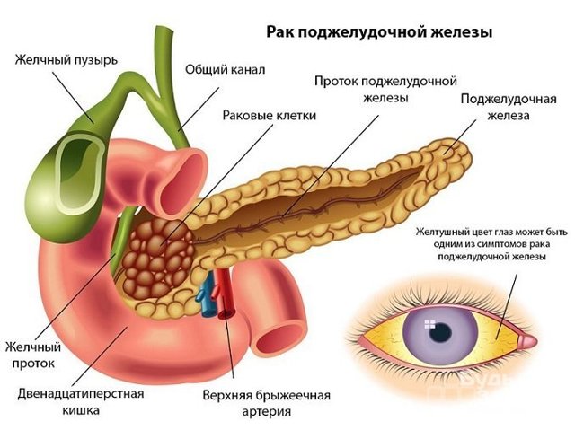 Какие анализы на онкомаркеры бывают