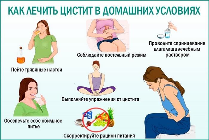 Лечение цистита в домашних условиях