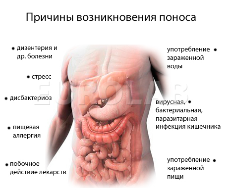 Лечение поноса (диареи)