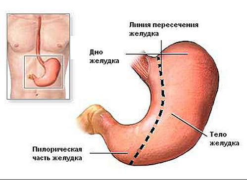 Метод рукавной гастропластики