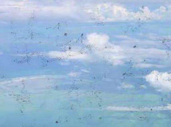 Мушки перед глазами: причины, лечение