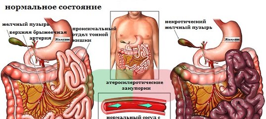 Полифекалия: причины, лечение, диета