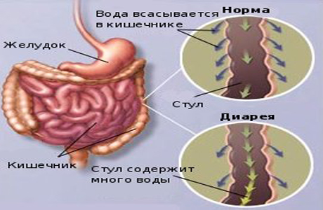 Признаки поноса