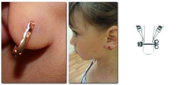 Прокалывание ушей — стоит ли делать?