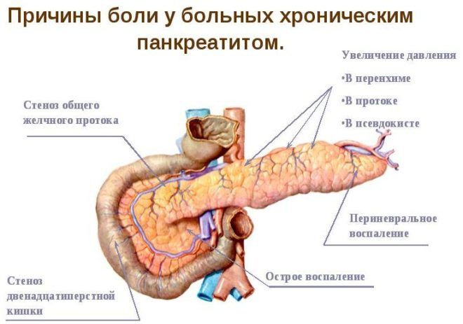 Стул при панкреатите: анализ, цвет кала