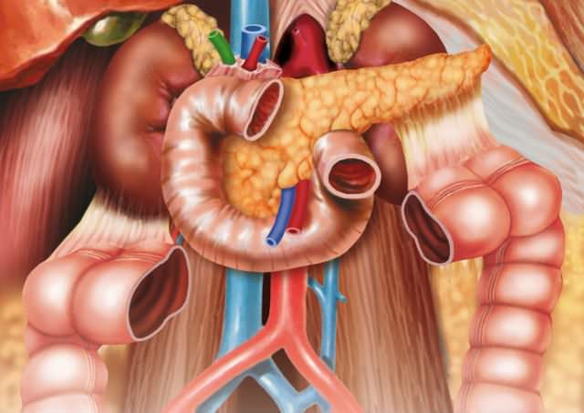 Варикоз вен малого таза (врвмт)