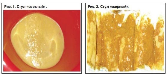 Жёлтый понос: причины и лечение