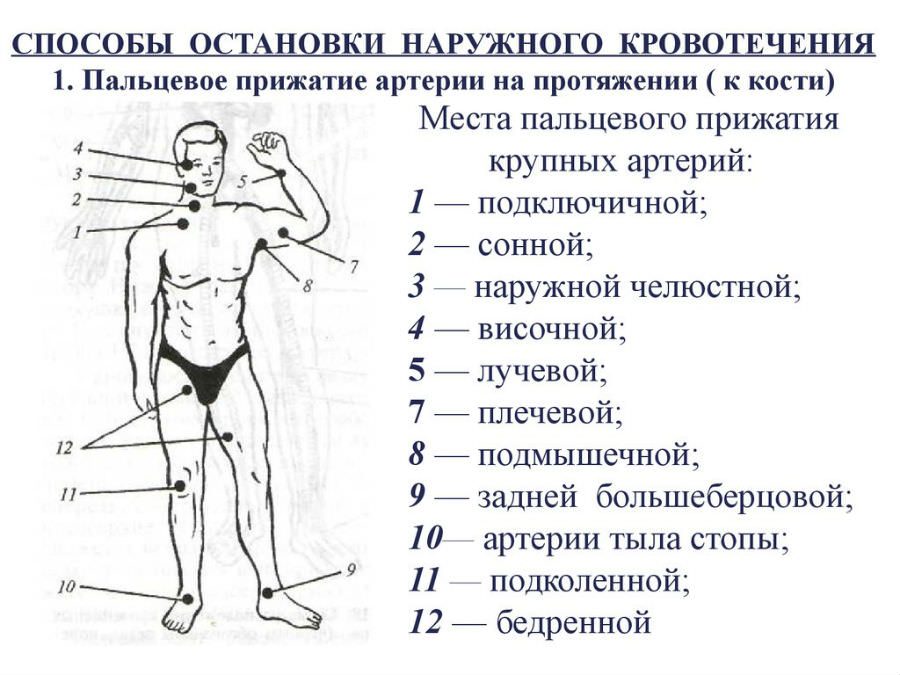 Отметьте на рисунке точки пальцевого прижатия артерий